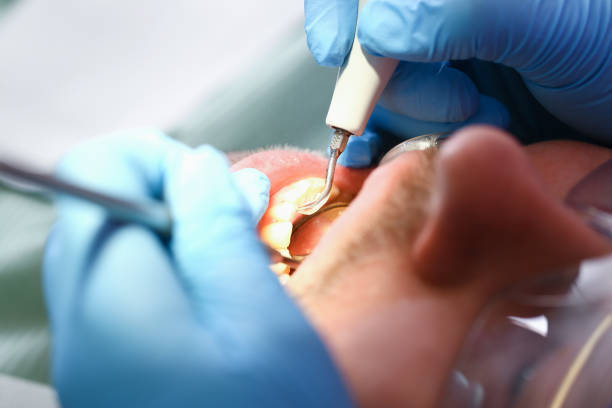 Best Cosmetic Emergency Dentistry in Utica, IN