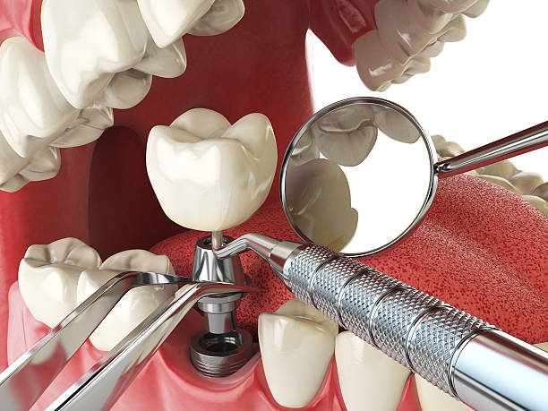 Best Weekend Emergency Dentist in Utica, IN