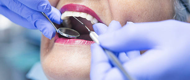 Best Emergency Dental Care for Broken or Chipped Teeth in Utica, IN